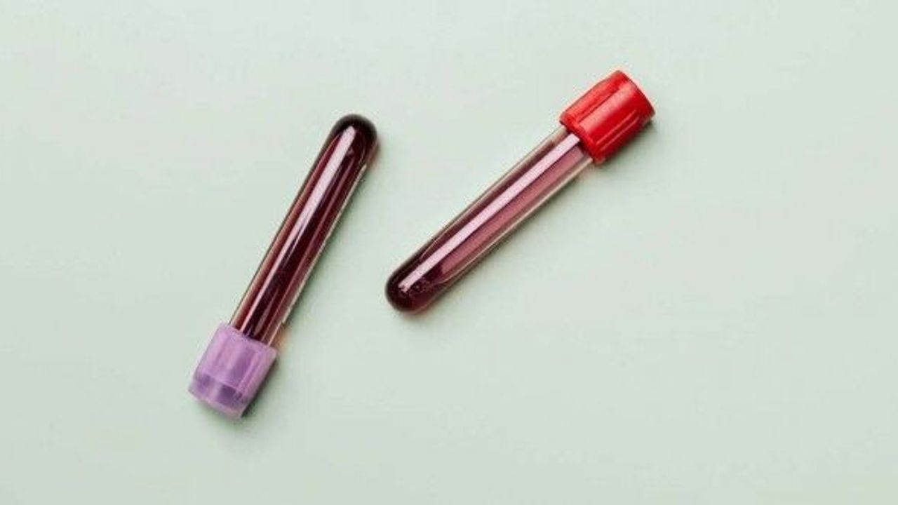 Laboratuvarda üretilen kan ilk kez insanda kullanıldı