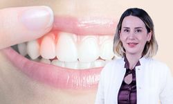 Uzmanından, "diş eksikliği, yüz estetiğini bozar" uyarısı