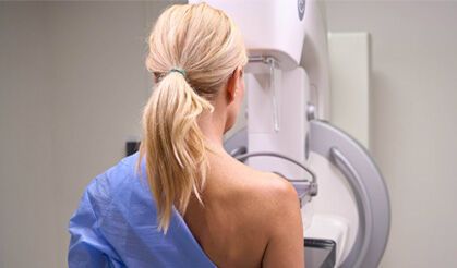 Her dört kanser vakasından biri meme kanseri