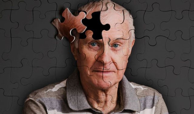Yeni Alzheimer ilacı umut oldu