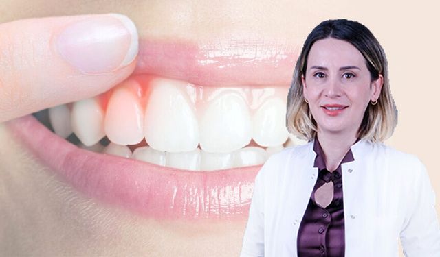 Uzmanından, "diş eksikliği, yüz estetiğini bozar" uyarısı